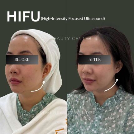 Feedback Khách Hàng