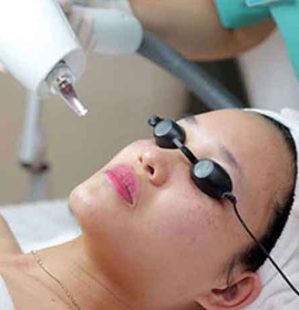 Laser tàng nhang, nám 