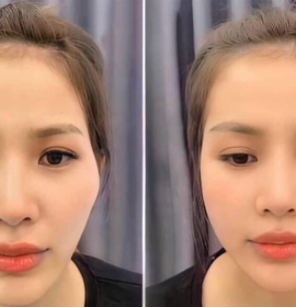 Messo thái dương
